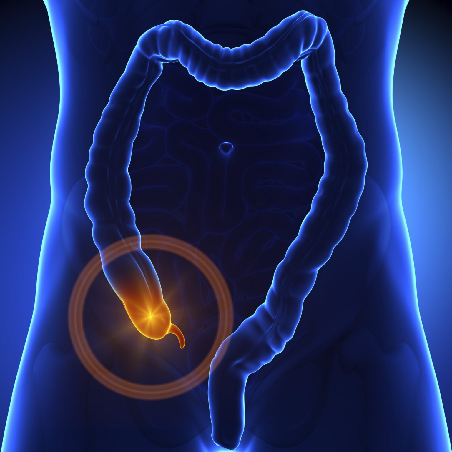 APPENDICITIS AND SURGERY – Heal Well Speciality Clinic