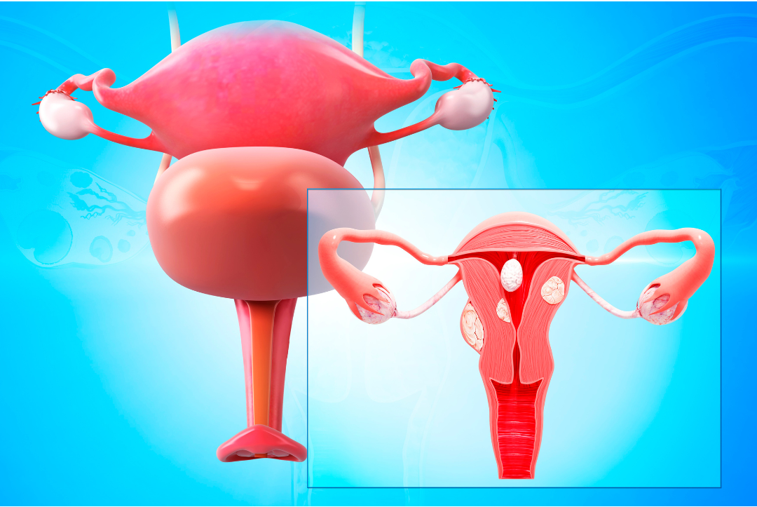 GYNAEC CANCERS: WHAT EVERY WOMAN SHOULD KNOW.. – Heal Well Speciality ...